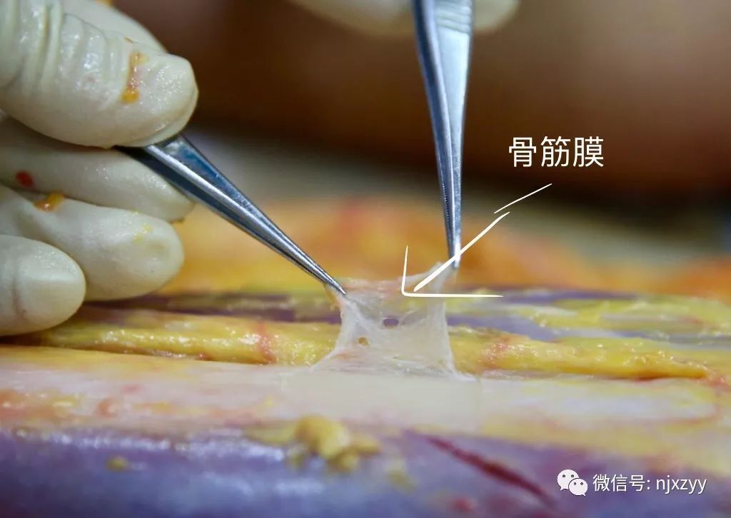 【培訓教學】新中醫(yī)·筋膜學應用解剖（新鮮大體）學習班